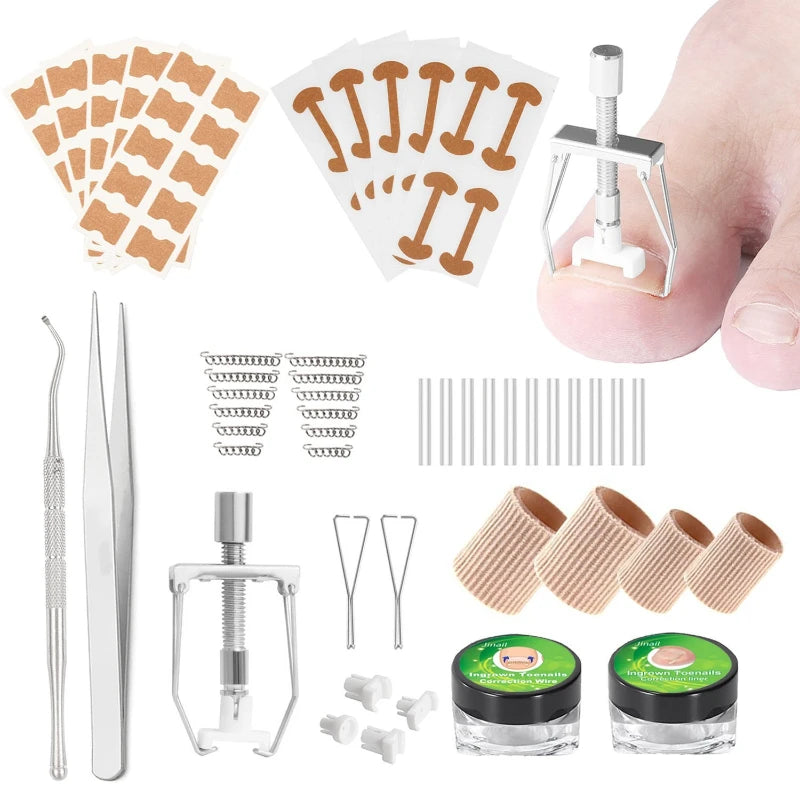 Corretor de Unha Encravada Alvion - Kit Completo Alívio Rápido Sem Cirurgia